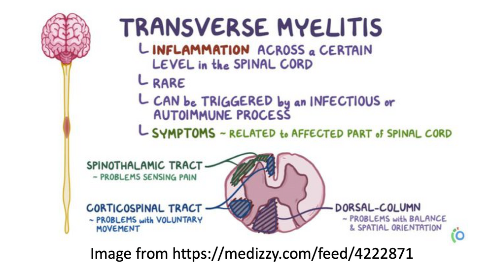 Illustration explaining transverse myelitis symptoms and causes.