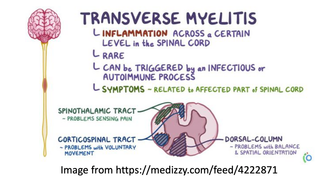 Illustration explaining transverse myelitis symptoms and causes.